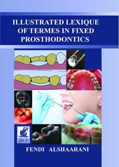 Illustrated Lexique Of Termes In Fixed Prosthodontics