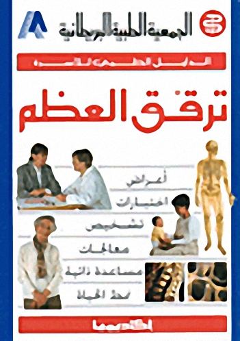 ترقق العظام