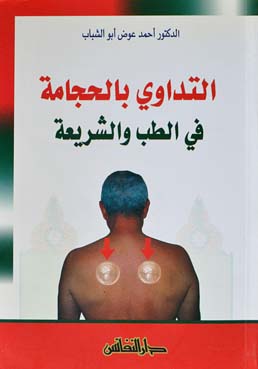 التداوي بالحجامة في الطب والشريعة