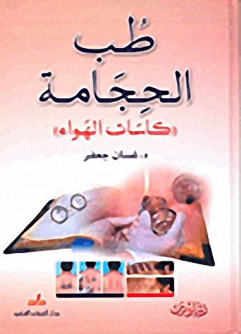 طب الحجامة 'كاسات الهواء