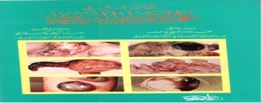 محاضرات في علم الأورام السريري