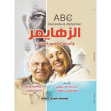 الزهايمر