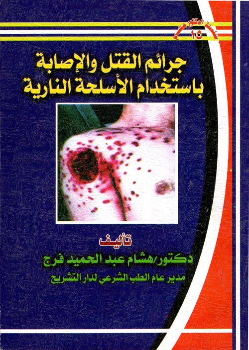 جرائم القتل والإصابة باستخدام الأسلحة النارية